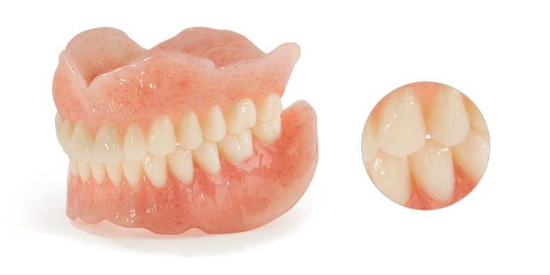 Traditional Classic Dentures