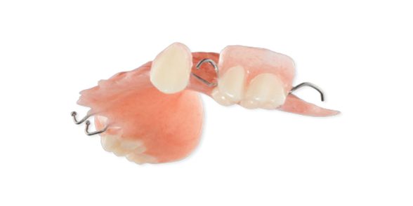 Wrought Wire Partial - Dental Crafters