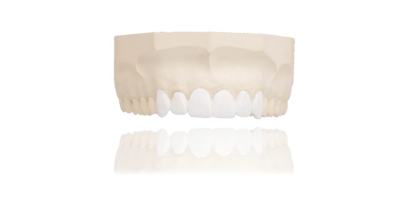 ULTRAflex Partial - Dental Crafters