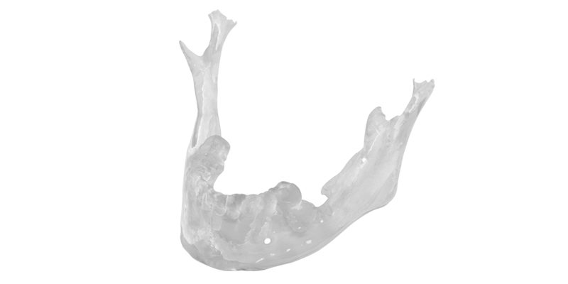 dc_imp_3dprinted