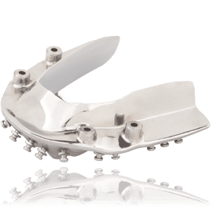 dc_implantbars_overdenture_bar_300