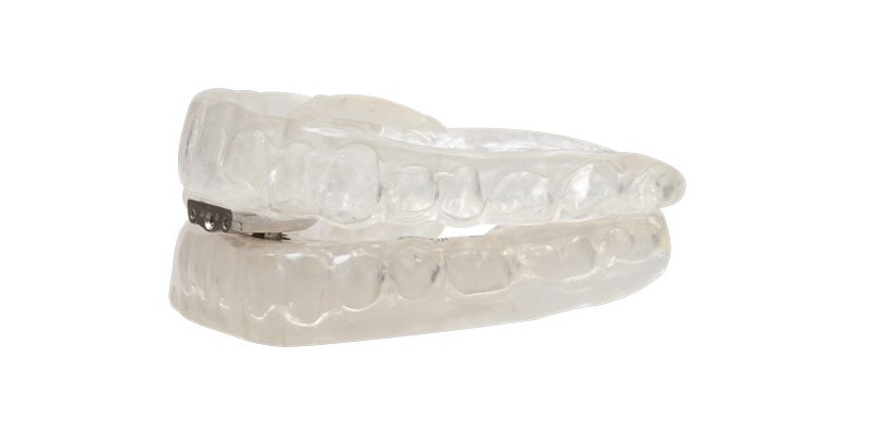 ULTRAflex Partial - Dental Crafters