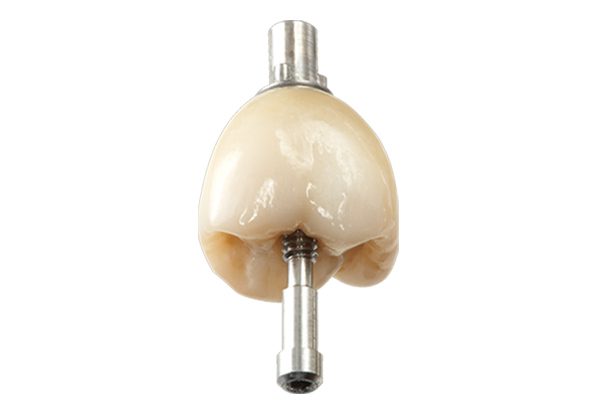 Implant Crowns Screw Occusa