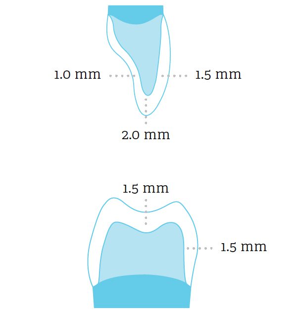 N.Dura Line Drawing