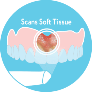 Scans Soft Tissue